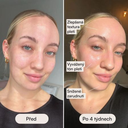 Eggo profesionálna LED maska pre obnovu pleti Ilumi Pro LED